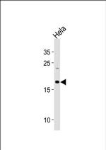 NDUFB10 Antibody in Western Blot (WB)