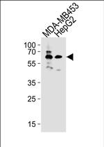 BTRC Antibody in Western Blot (WB)