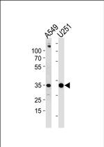 ASB9 Antibody in Western Blot (WB)