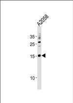 SSNA1 Antibody in Western Blot (WB)