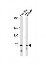 TRIF Antibody in Western Blot (WB)
