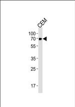 GBP2 Antibody in Western Blot (WB)