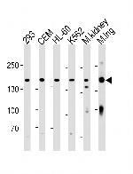 PKP4 Antibody in Western Blot (WB)