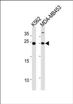 SSPN Antibody in Western Blot (WB)
