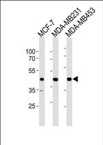SGCG Antibody in Western Blot (WB)