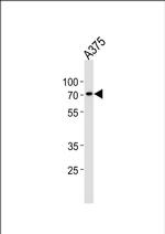 ST7L Antibody in Western Blot (WB)