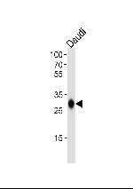 HLA-DQB1 Polyclonal Antibody