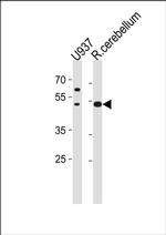 SLC25A25 Antibody in Western Blot (WB)