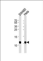 NDUFA4 Antibody in Western Blot (WB)