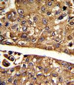 MDH1 Antibody in Immunohistochemistry (Paraffin) (IHC (P))