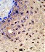 PAX3 Antibody in Immunohistochemistry (Paraffin) (IHC (P))