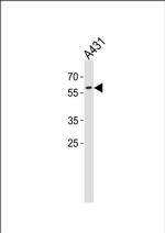 PAX3 Antibody in Western Blot (WB)
