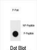 Phospho-ErbB2 (HER-2) (Tyr1005) Antibody in Dot Blot (DB)