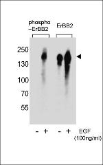 Phospho-ErbB2 (HER-2) (Tyr1005) Antibody in Western Blot (WB)