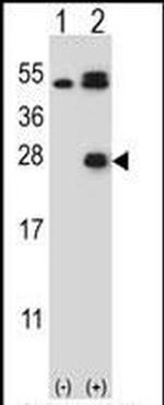 Kallikrein 6 Antibody in Western Blot (WB)