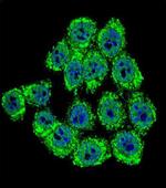 NF2 Antibody in Immunocytochemistry (ICC/IF)