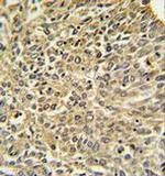 NF2 Antibody in Immunohistochemistry (Paraffin) (IHC (P))