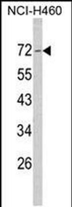NF2 Antibody in Western Blot (WB)