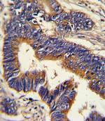 Glucagon Antibody in Immunohistochemistry (Paraffin) (IHC (P))