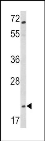 Glucagon Antibody in Western Blot (WB)