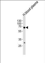 Fibrinogen alpha Antibody in Western Blot (WB)