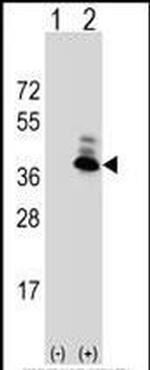 Aspartoacylase Antibody in Western Blot (WB)
