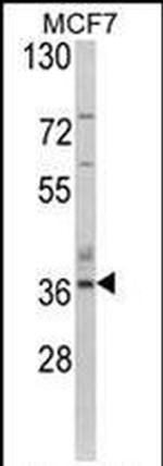 Aspartoacylase Antibody in Western Blot (WB)