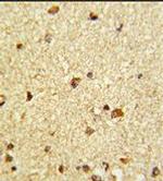 CBF beta Antibody in Immunohistochemistry (Paraffin) (IHC (P))
