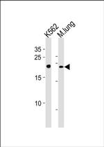 CBF beta Antibody in Western Blot (WB)