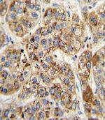 MCCC2 Antibody in Immunohistochemistry (Paraffin) (IHC (P))