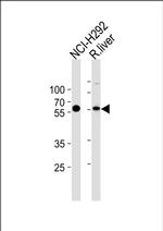 MCCC2 Antibody in Western Blot (WB)