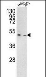 TMPRSS3 Antibody in Western Blot (WB)