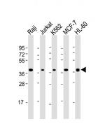 CD62L Antibody in Western Blot (WB)