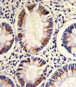 ARGBP2 Antibody in Immunohistochemistry (Paraffin) (IHC (P))