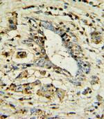 Apolipoprotein L1 Antibody in Immunohistochemistry (Paraffin) (IHC (P))