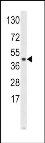SKP2 Antibody in Western Blot (WB)