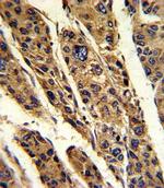TPT1 Antibody in Immunohistochemistry (Paraffin) (IHC (P))