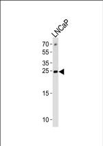 TPT1 Antibody in Western Blot (WB)