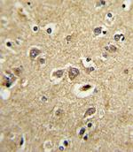 RAP Antibody in Immunohistochemistry (Paraffin) (IHC (P))