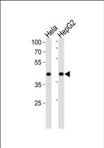 RAP Antibody in Western Blot (WB)