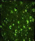 ABI1 Antibody in Immunohistochemistry (Paraffin) (IHC (P))