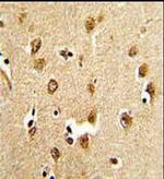 ABI1 Antibody in Immunohistochemistry (Paraffin) (IHC (P))