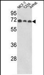 ABI1 Antibody in Western Blot (WB)
