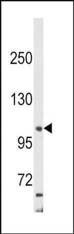 AP2A2 Antibody in Western Blot (WB)