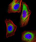 MICA Antibody in Immunocytochemistry (ICC/IF)