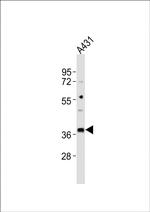 MICA Antibody in Western Blot (WB)