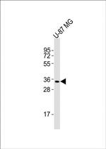 MICA Antibody in Western Blot (WB)