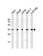 MICA Antibody in Western Blot (WB)