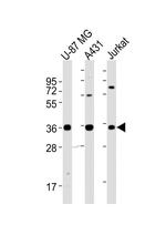 MICA Antibody in Western Blot (WB)