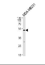MICA Antibody in Western Blot (WB)